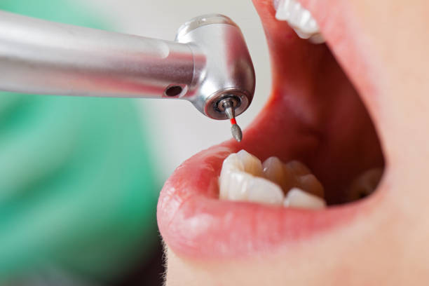 Reliable TX Emergency Dental Service Solutions